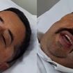 Humorista Bolachinha atualiza estado de saúde após acidente no 'Acerte ou Caia!', da Record: 'Torci a perna e...'